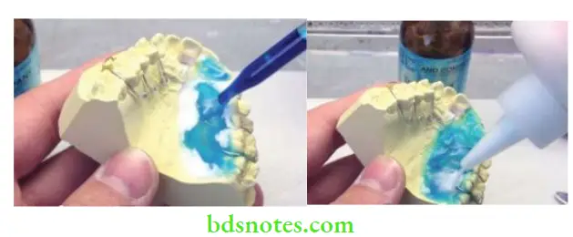 Denture Resins And Polymers Salt and pepper technique.