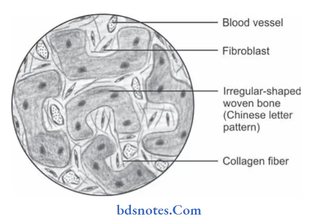 Diseases of Bone and Joints Fibrous dysplasia