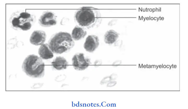 Diseases of blood and blood forming organs Chronic myeloid leukemia