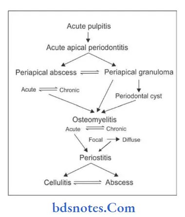 Diseases of the Pulp and Periapical Tissues sequelae of acute pulpitis