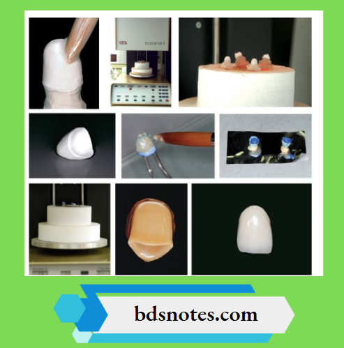 Fabrication of an In-Ceram restoration