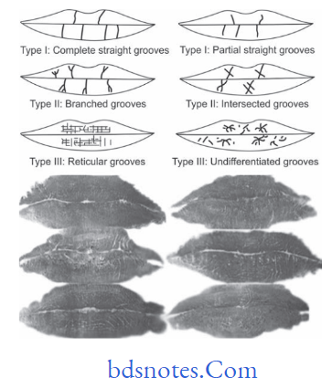 Forensic Odontology Lip patterns