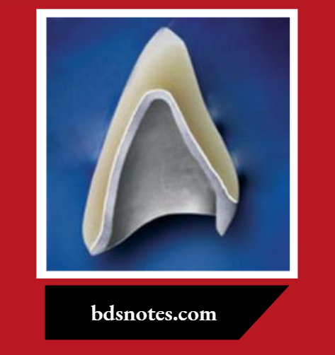 Metal ceramic system