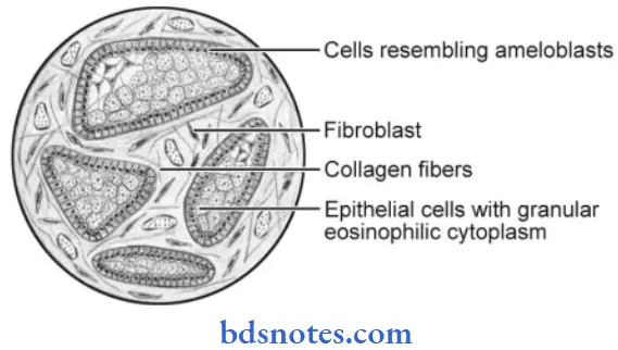 Neoplasm Granular Cell Ameloblastoma(H & E Stain)