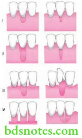 Periodontics Mucogingival Surgery Periodontal Plastic Surgery PD Miller's classification of gingival recession