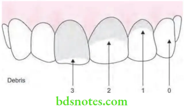 Public Health Dentistry Indices In Dental Epidemiology Scoring method for debris
