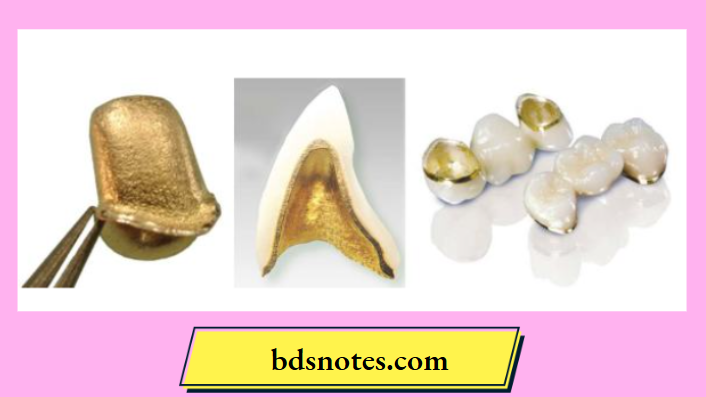 Sintered gold alloy foil ceramic restorations