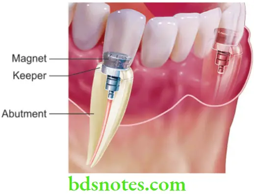 Structure and Properties Dental Materials Dental magent 1