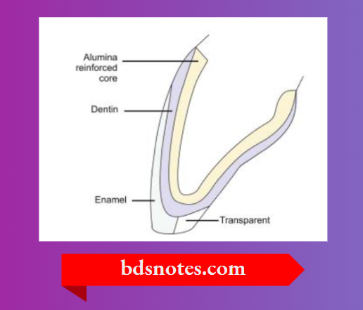 The porcelain jacket crown with aluminous core