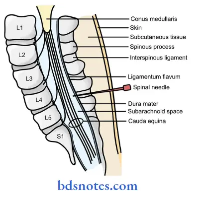 Back-Of-The-Neck-lumbar-puncture-in-an-adult
