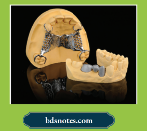 Model Cast and Die Materials: Types, Properties, and Applications - BDS ...