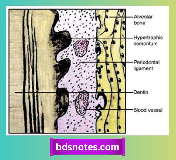 Cementum And Cementicles Diagram
