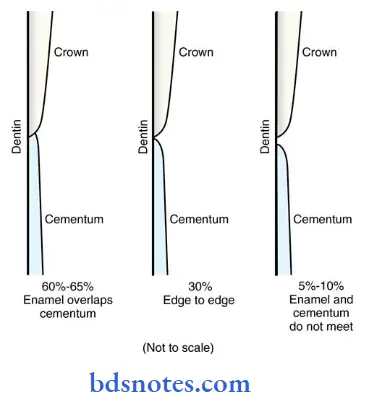 Cementum-types-of-cementoenamel-junction