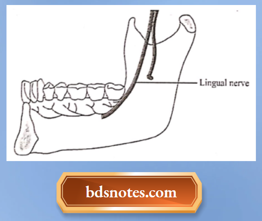 Close Relation Of Lingual Nerve To The Last Molar Tooth