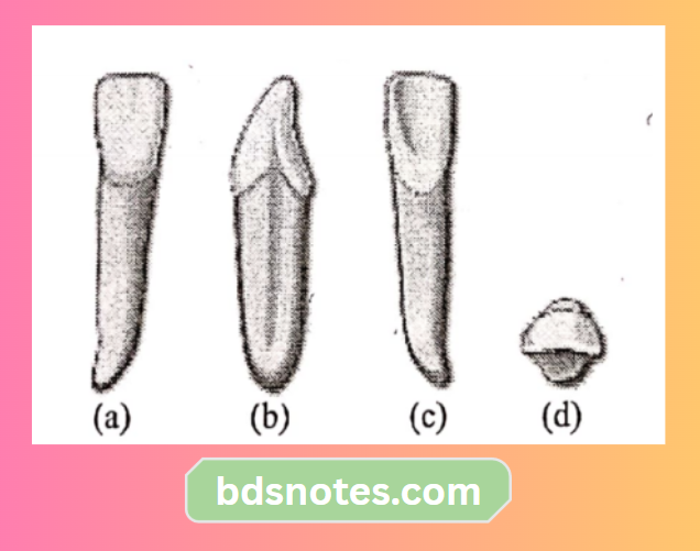 Deciduous Lower Central Incisor Lingual View