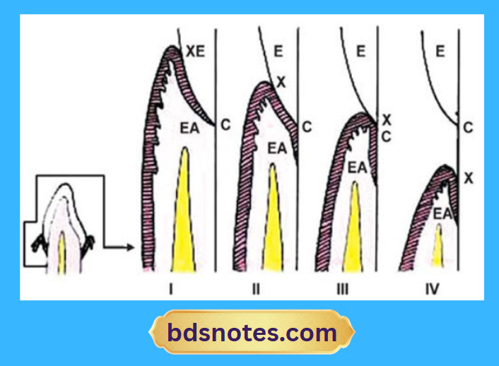 Dentogingival Junction Changes With Age