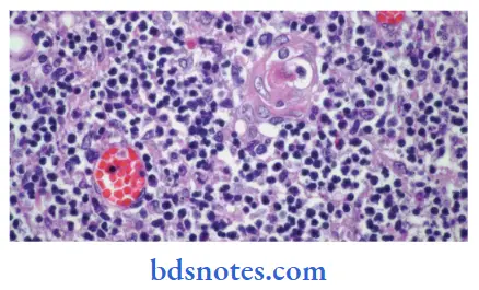 Histology-thymus-high-power-view