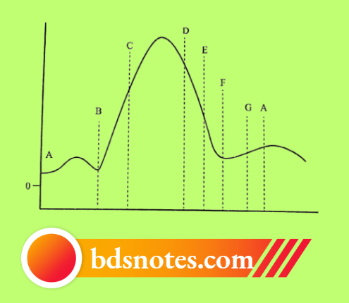 Intraventricular Pressure Curve