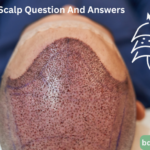 Layers Of Scalp Question And Answers