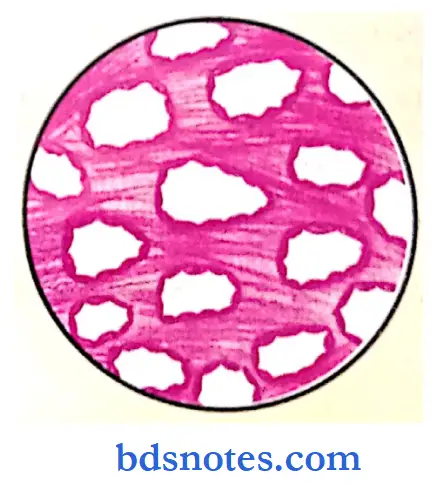 Oral Pathology Slides capillary haemangioma