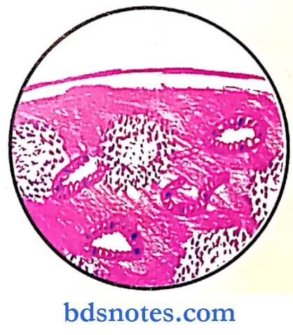 Oral Pathology Slides capillary secondary deposits