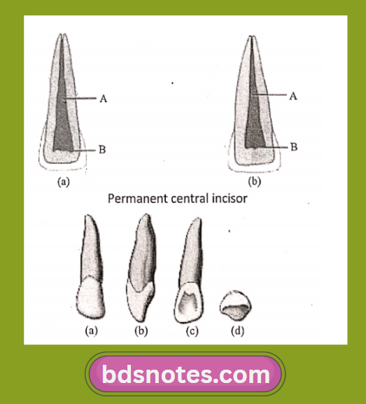 Pri Right Lateral Incisor Lingual View