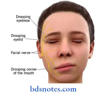 Scalp-Temple-And-Face-bells-palsy