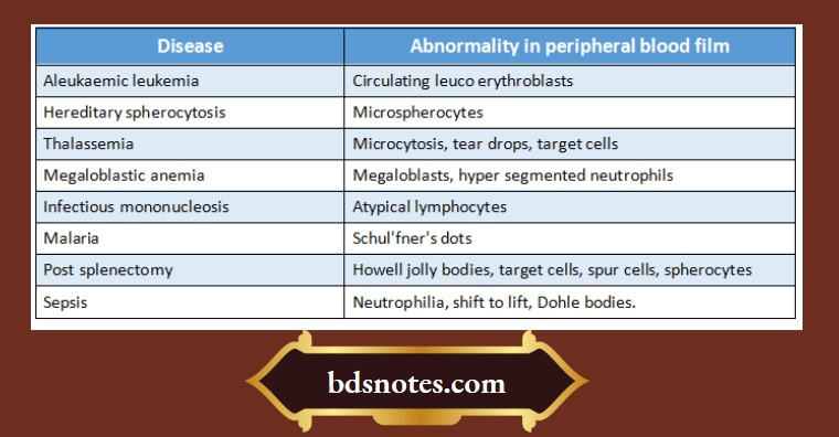 Thalassemia.