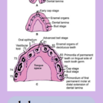 Tooth_Development_Stages_Detailed_Diagram