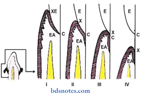 stages of dentogingival junction