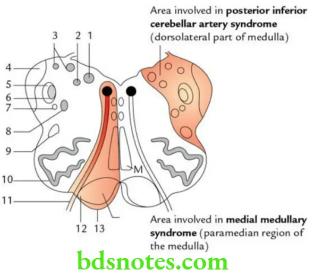 Brain Overview of brain and brainstem Transverse section of the upper part of the medulla