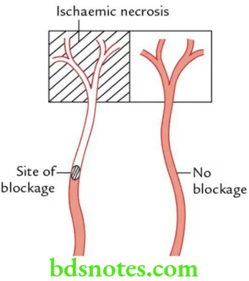 General Anatomy Cardiovascular system Anatomical end artery