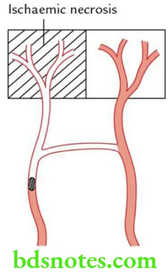 General Anatomy Cardiovascular system Functional end artery