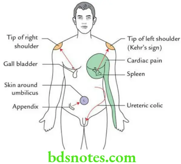General Anatomy Nervous system Important sites of referred pain 1