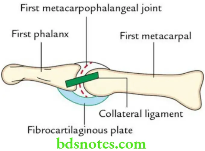 Upper Limb Joints of the upper limb First right metacarpophalangeal joint