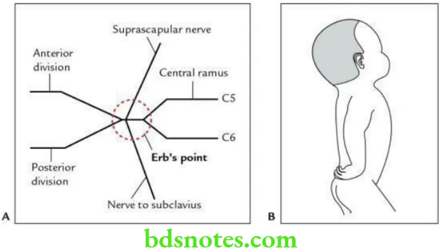 Upper Limb Pectoral region and axilla Erb Duchenne paralysis
