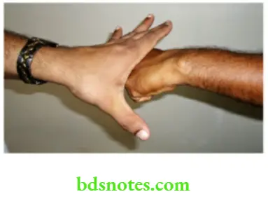 Examination of Swellings, Tumours, Cysts and Neck Swelling Contraction of extensors of the wrist