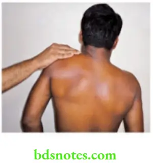 Examination of Swellings, Tumours, Cysts and Neck Swelling Contraction of trapezius