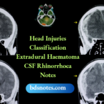 Head Injuries Classification Extradural Haematoma CSF Rhinorrhoea Notes