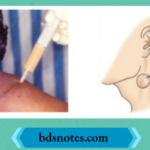 Needle Aspiration Of Abscess