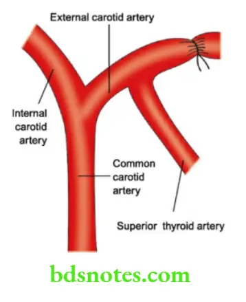 Oral Cavity, Odontomes, Lip And Palate Ligation Of external Carotid Artery