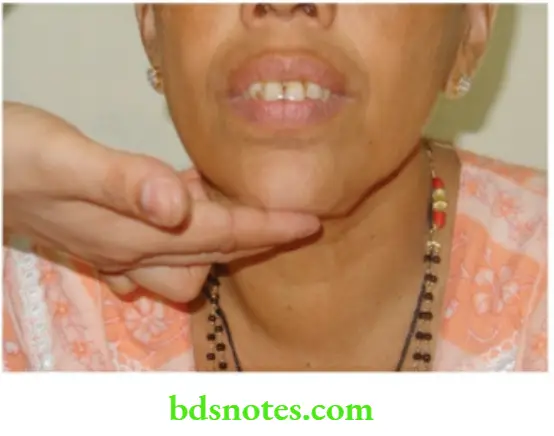 The Thyroid Gland Neck Flexion Test Or Chin Test