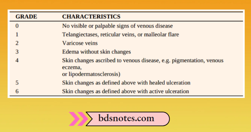 Varicose Veins Chronic Venous Disease Classification