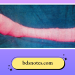 Varicose Veins Elastic Crepe Bandage Ulcer Healing