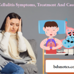 Cellulitis Symptoms, Treatment And Causes