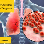 Community Acquired Pneumonia Diagnosis