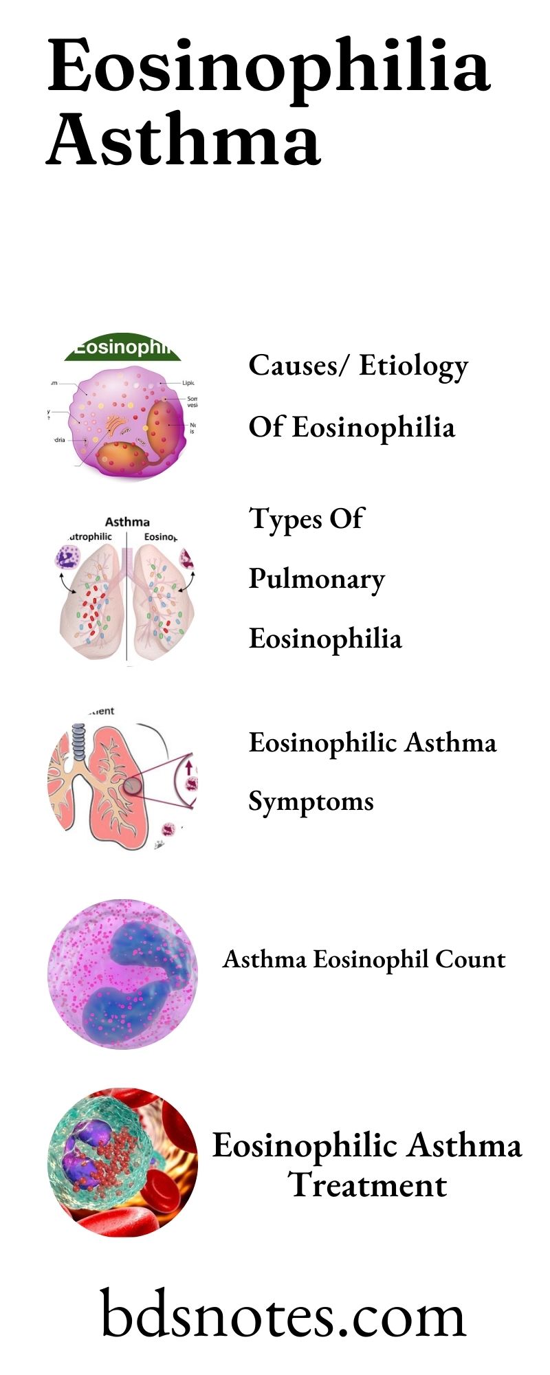 Eosinophilia Asthma Treatment
