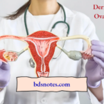 Dermoid Cyst Ovary Causes Notes