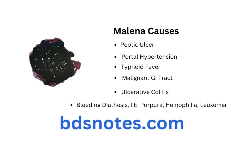 Dysphagia Hematuria General Medicine Malena Causes