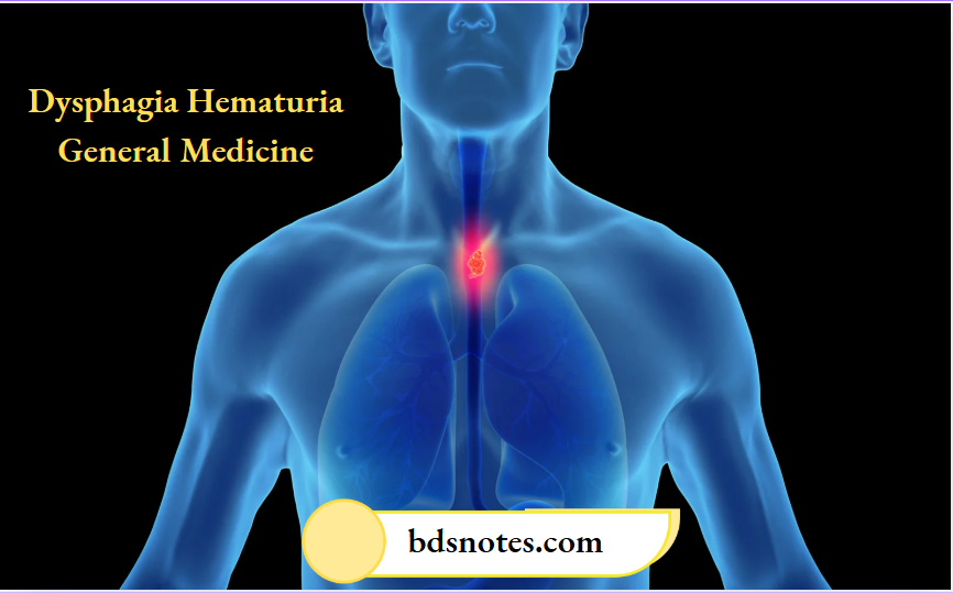 Dysphagia Hematuria General Medicine